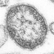 220px-Measles_virus.JPG