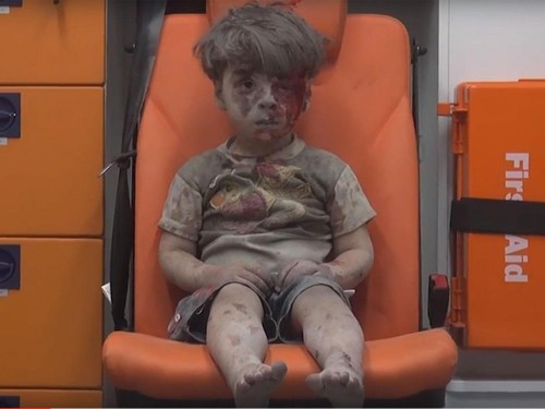 Omran Daqneesh Alepo 2016-08