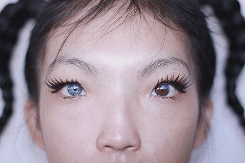 1-heterochromia-iridum.jpg