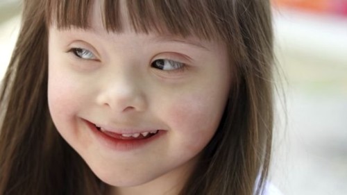 crianca-menina-sindrome-down-20121026-size-620.jpg