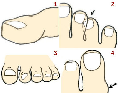 tipos-diedos-pes-02.jpg tipos-dedos-pes-02.jpg
