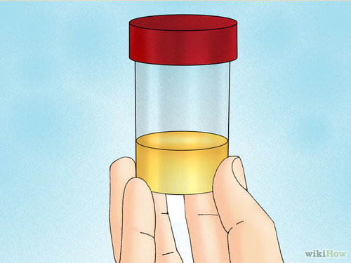 728px-Get-a-Urine-Sample-from-a-Male-Dog-Step-11.j