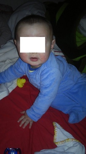 gustavo pele atopica.jpg