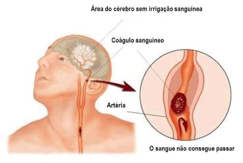 IMG AVC 1 sua_saude_elaine.jpg