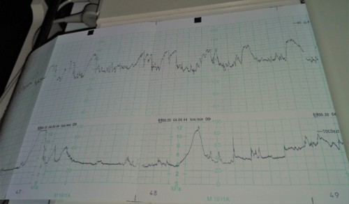 IMG_20161119_231210 (2).jpg IMG_20161119_231210 (2).jpg