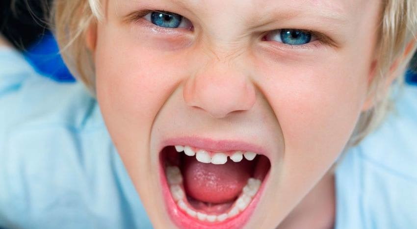 pré adolescencia.jpg