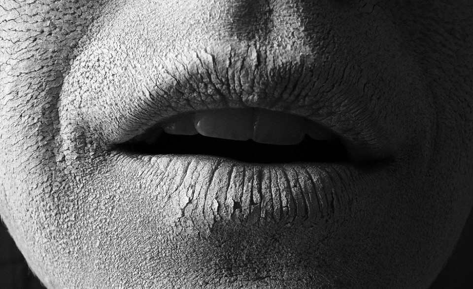 desidratação.jpg desidratação.jpg