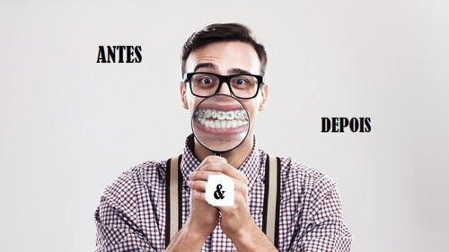 tratamento-prótese-dentária-com-aparelho-ortodô