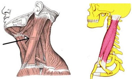 Esternocleidomastoideo Esternocleidomastoideo