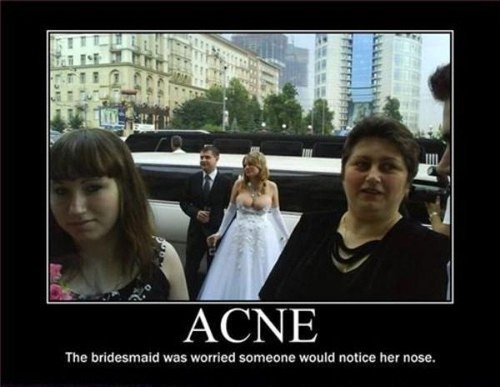 Acne