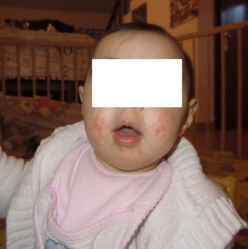 gabriela pele atopica.jpg