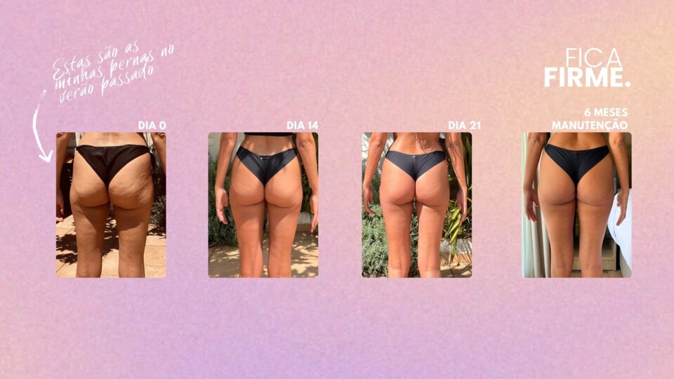 ISI 28 CELULITE & LIPEDEMA (1920 × 1080 px).jp