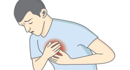 ataque cardiaco1.jpg