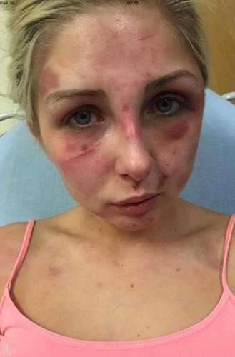 ng7764331.jpg ng7764331.jpg