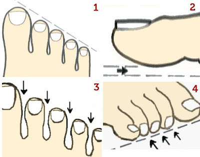 tipos-dedos-pes-01.jpg tipos-dedos-pes-01.jpg
