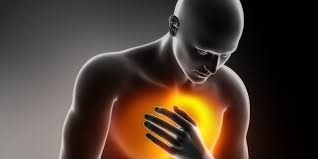 Enfarte Agudo do Miocárdio.jpg