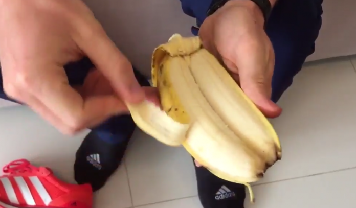 bananas siamesas.png