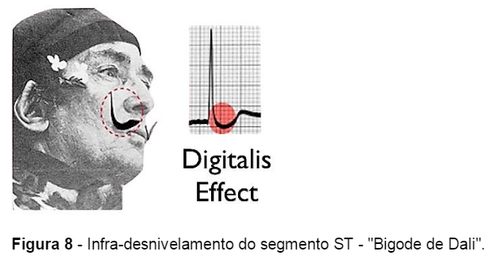 efeito digitalico.PNG