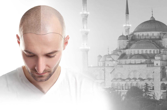 capilar.png capilar.png