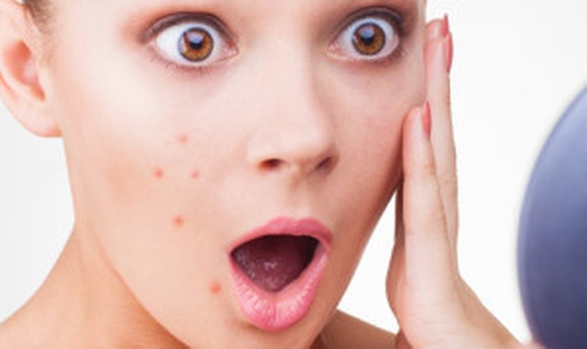 acne-como-tratar-espinhas-dicas.jpg