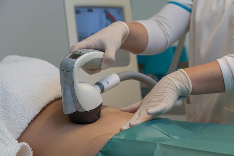 VelaShapeIII_mafalda.jpg VelaShapeIII_mafalda.jpg