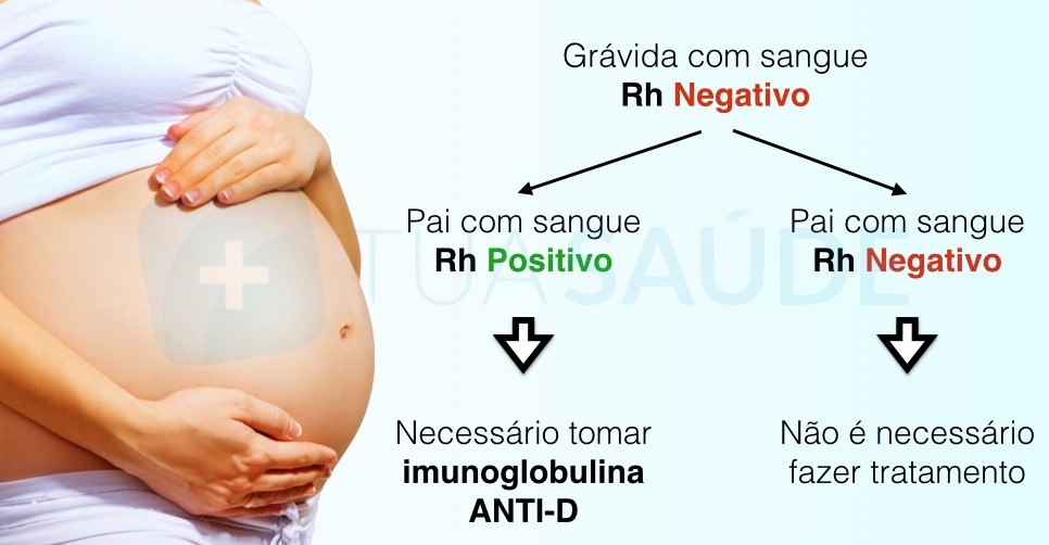 incompatibilidade do grupo Rh entre mãe e bebé.j