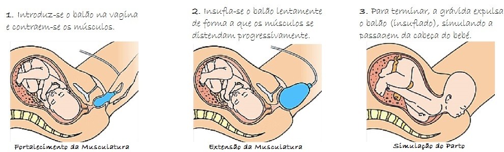 utilizaçao do EPINO.jpg