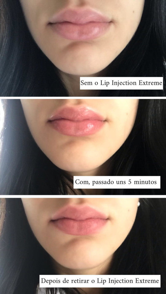 lips.jpg lips.jpg