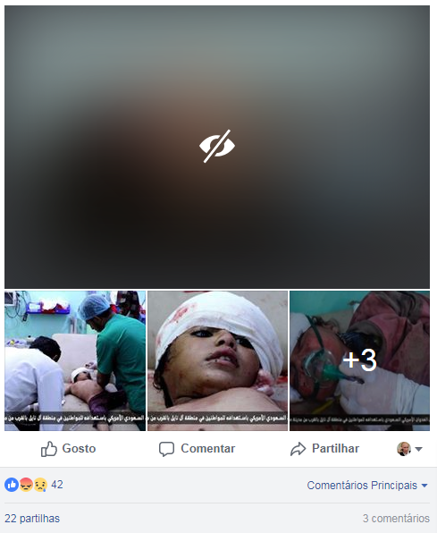 يحدث في #صعدة .!