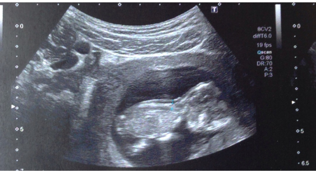 image.jpeg image.jpeg