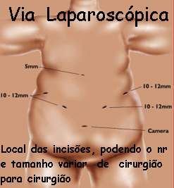 vialaparoscopica.GIF