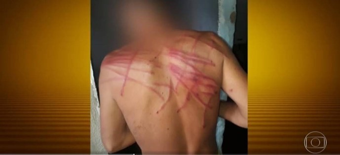 Violência movida pelo racismo: garoto negro agredido