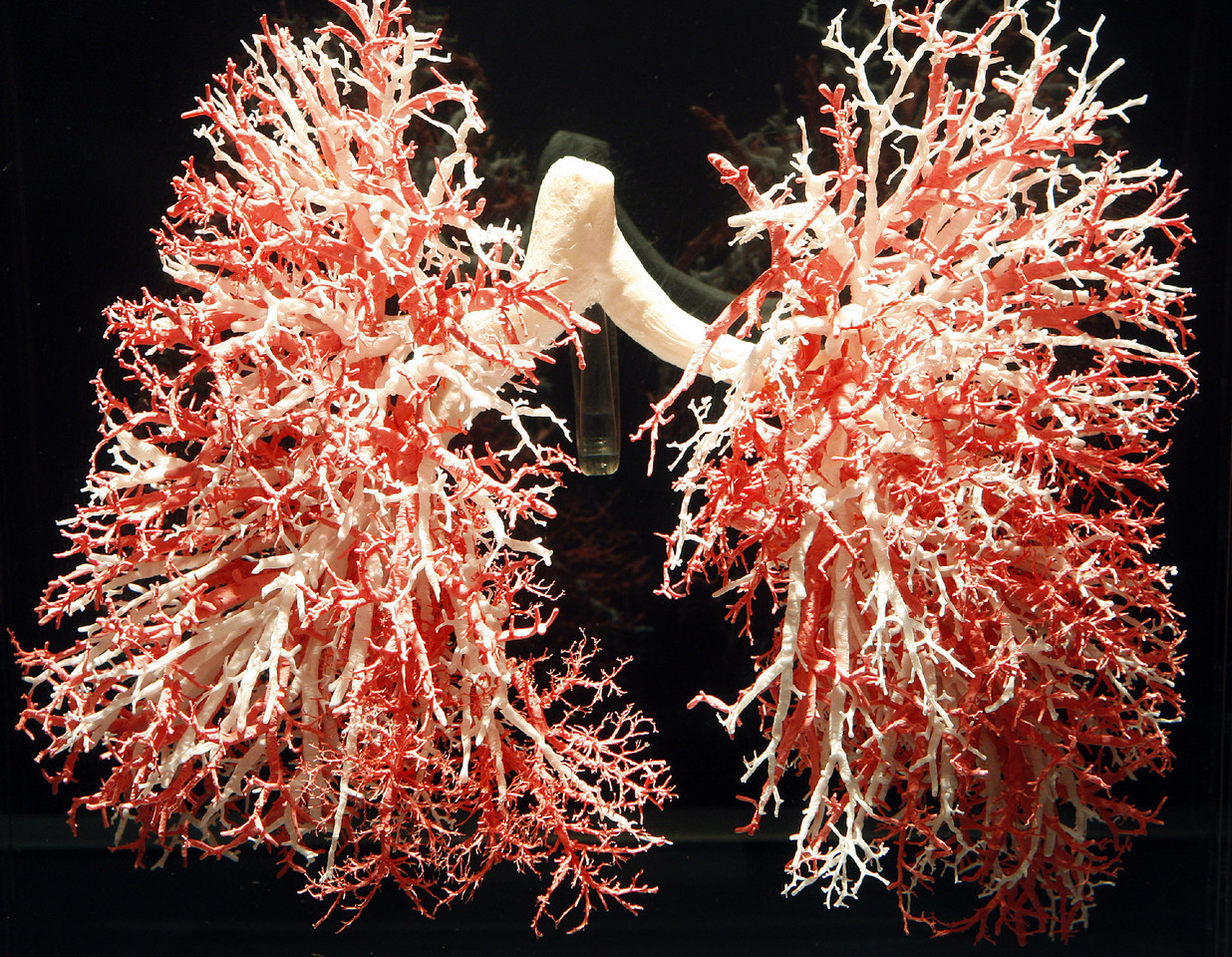 Bodies-0217.jpg Bodies-0217.jpg