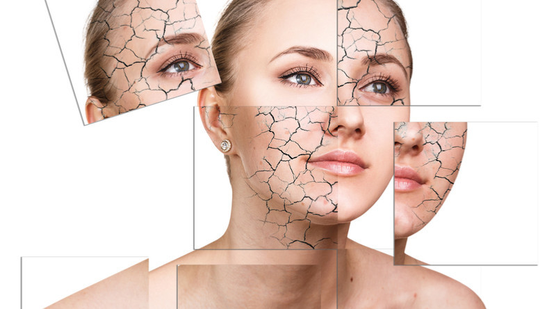 Home-Remedies-to-Combat-Dry-Skin-and-Chapped-Lips.