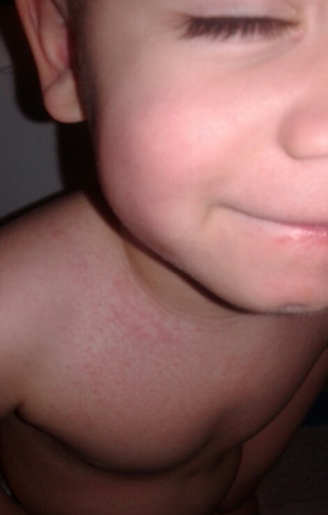 2016-04-27 10 (2).51