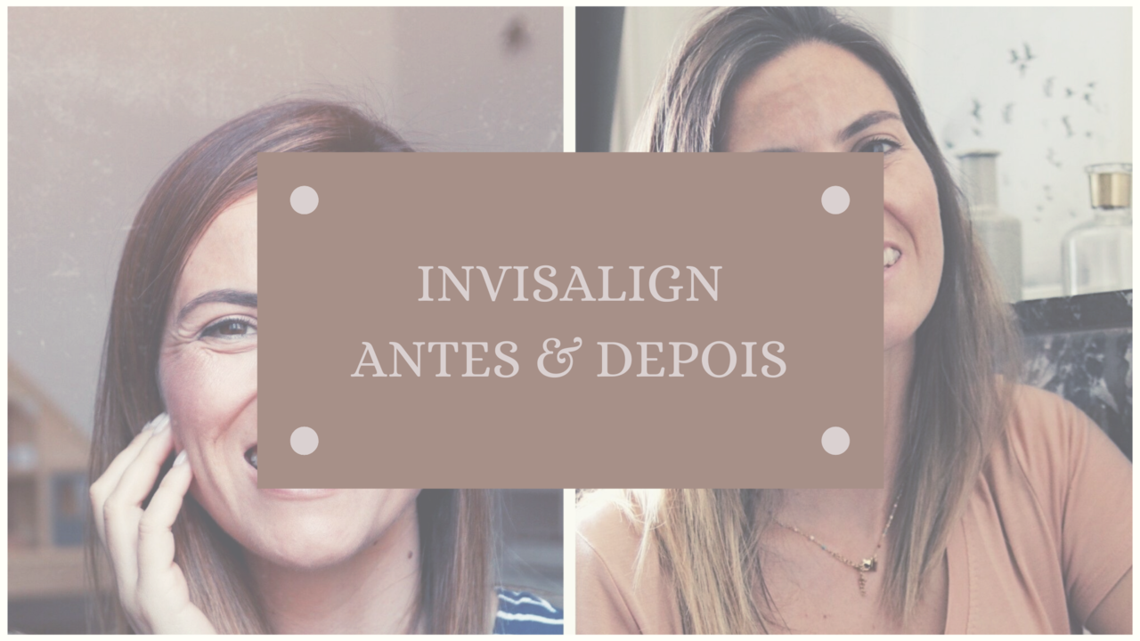 antes e depois com invisalign antes e depois com invisalign