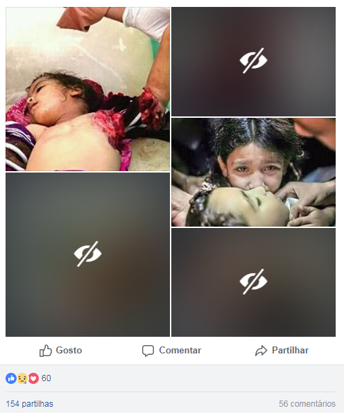 عندما مات ضمير العالم ولايرى إلا بعينا واحده تمادى البغاة المستكبرين وبكل همجيه وقبح وتغطرس أرعن جبناء حقراء أشباه رجال يقتلون البرائة في اليمن لايرقبون في مؤمنا إلا ولاذمه فلا نملك إلا التوكل على الله جبار السموات والأرض وحمل السلاح لمواجهتهم والتصدي لبغيهم حتى يكسر الله شوكتهم ونستأصل شأفتهم فهم شرمستطير وعدوا غاشم والله معنا ناصرا ومعينا