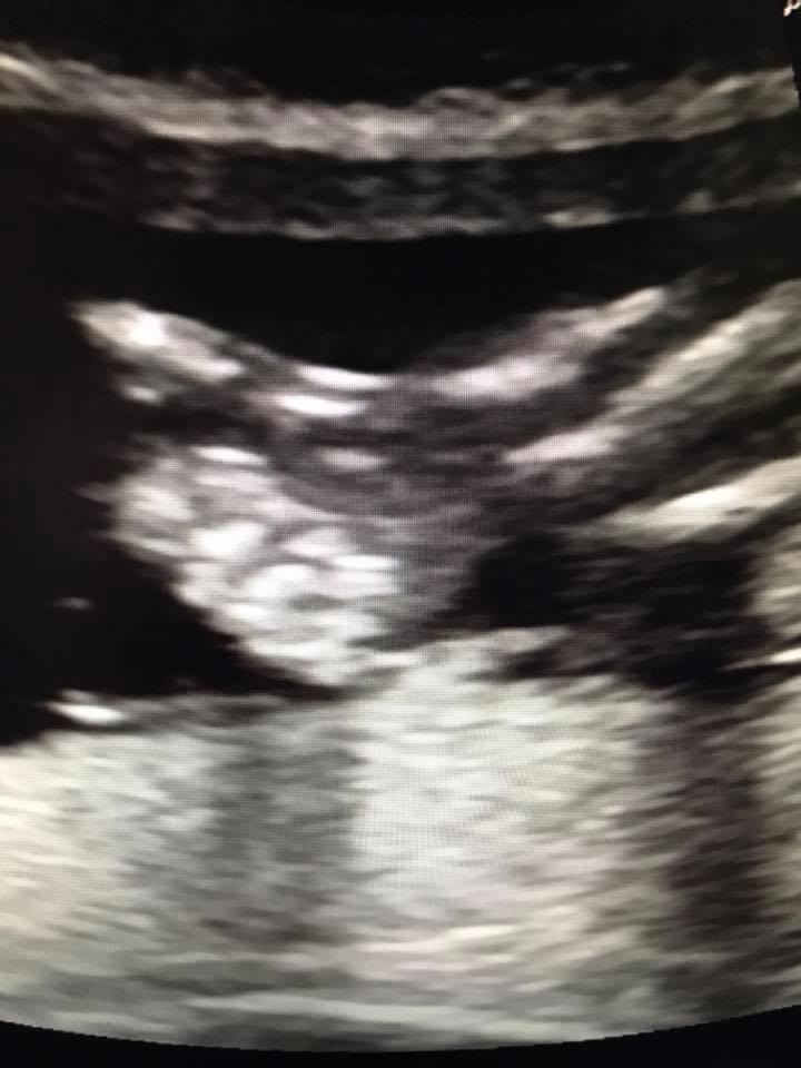 21272111_1493781120716525_3542814121557843683_n.jp