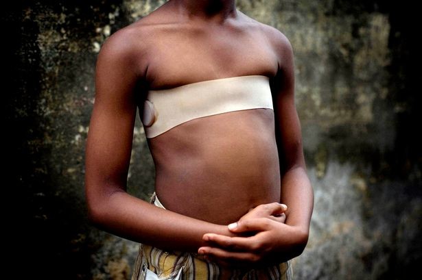breast ironing.jpg