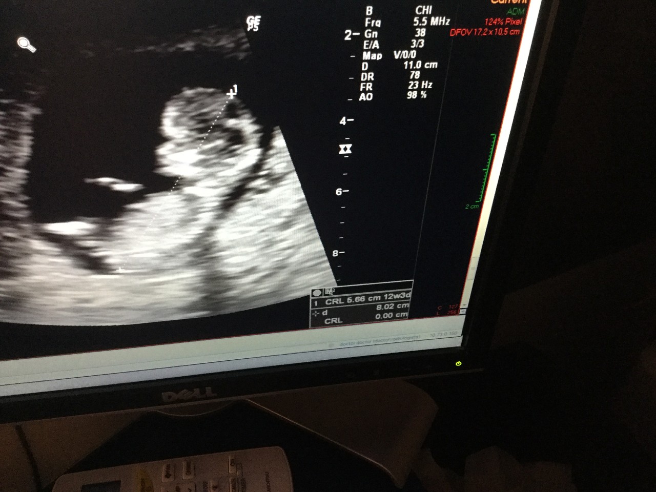 image.jpeg image.jpeg