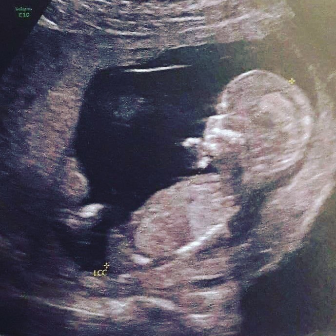 IMG_9416.JPG IMG_9416.JPG