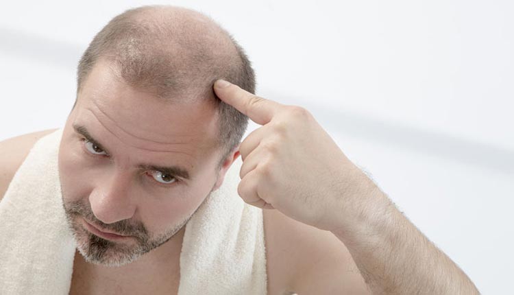 queda-de-cabelo-diferente-de-calvicie.jpg