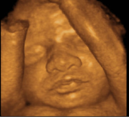 Eco 3d Mae Em Apuros