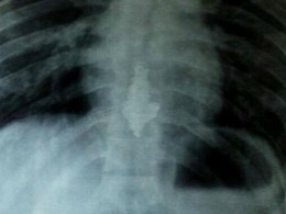 colar engolido.gif colar engolido.gif