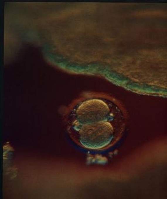 nascimento bebé gravidez gestação parto