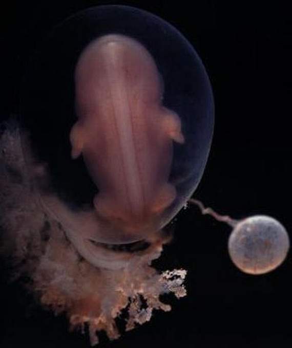 nascimento bebé gravidez gestação parto