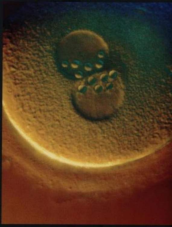 nascimento bebé gravidez gestação parto