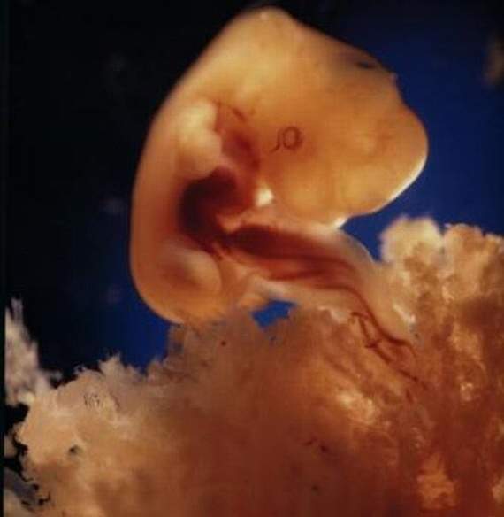 nascimento bebé gravidez gestação parto