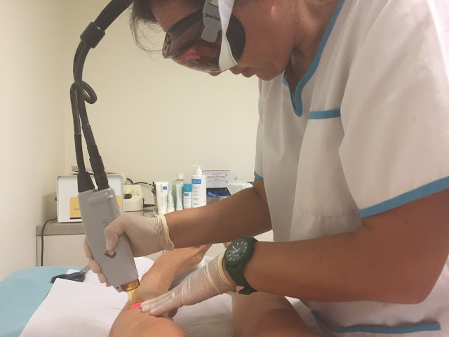 sentidos saúde e beleza + depilação definitiva + laser alexandrite + depilação + cuidados de beleza + depilação