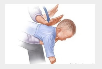 perigos + bebés e crianças + desengasgamento + engasgamento + prevenção + cuidados + enfª Carmen Ferreira + o que fazer em caso de engasgamento de um bebé perigos + bebés e crianças + desengasgamento + engasgamento + prevenção + cuidados + enfª Carmen Ferreira + o que fazer em caso de engasgamento de um bebé